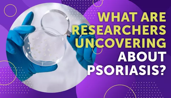 What Are Researchers Uncovering About Psoriasis? | MyPsoriasisTeam