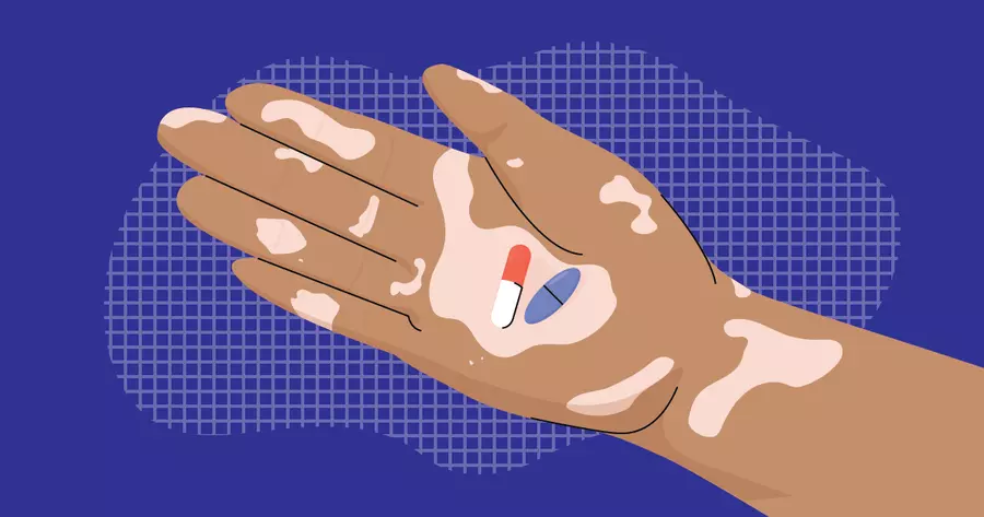 how to put a vitamin b12 injection Safe B12 Injection Guide at Home