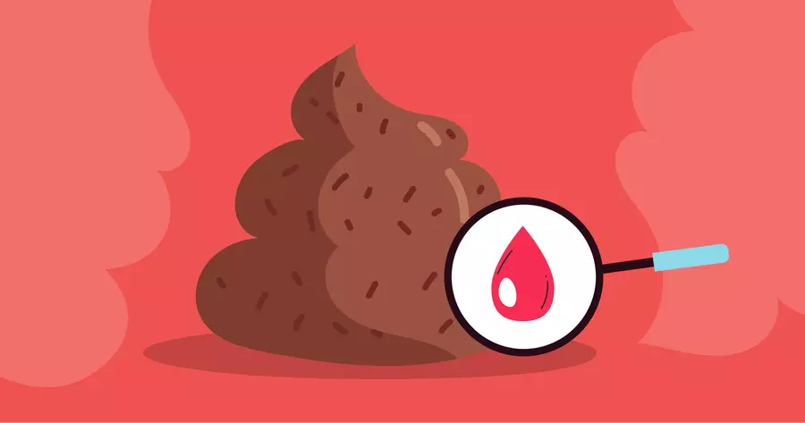Sangre En Las Heces Con Colitis Ulcerosa qu Es Normal Y Cu ndo Es Sangre En Las Heces Con Colitis Ulcerosa qu Es Normal Y Cu ndo Es