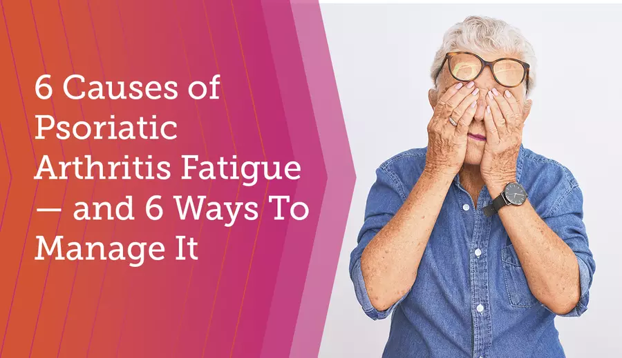 6 Causes of Psoriatic Arthritis Fatigue — and 6 Ways To Manage It