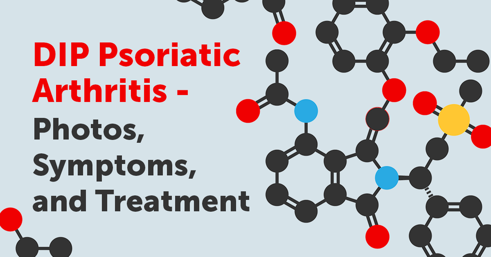 Psoriatic Arthritis MyPsoriasisTeam