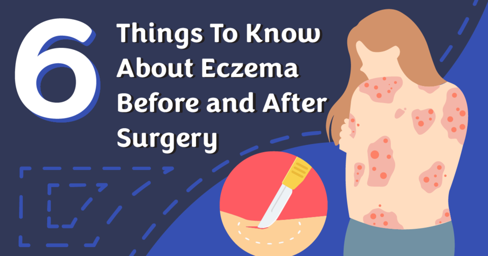 Living with Eczema MyEczemaTeam