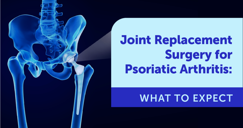 The social network for those living with psoriasis and psoriatic