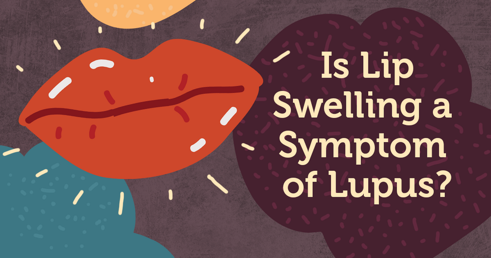 Your Guide to Systemic Lupus Erythematosus MyLupusTeam