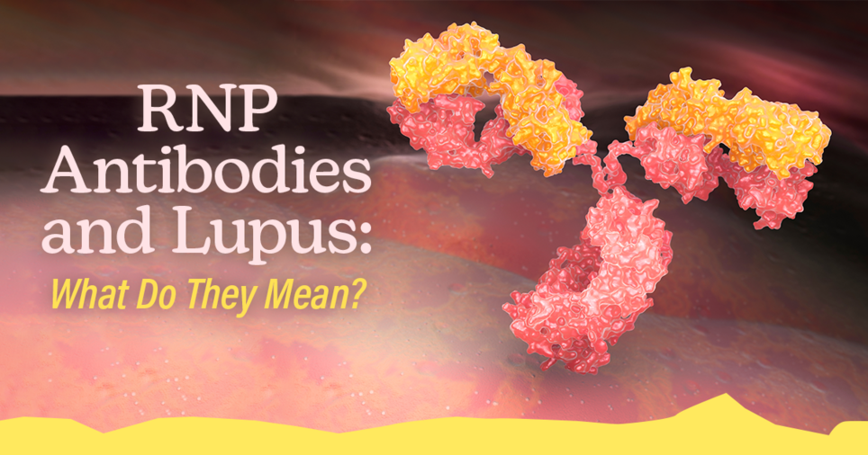 Lupus Information MyLupusTeam