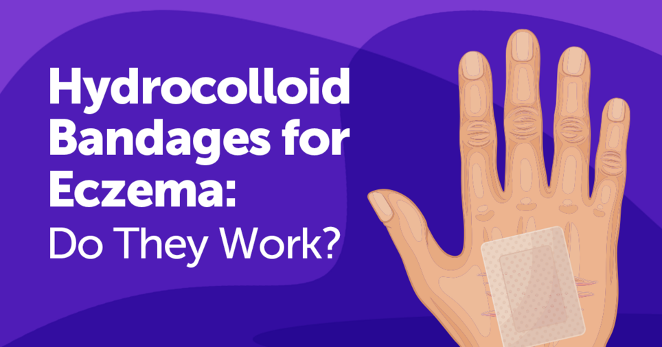 Eczema Treatments MyEczemaTeam