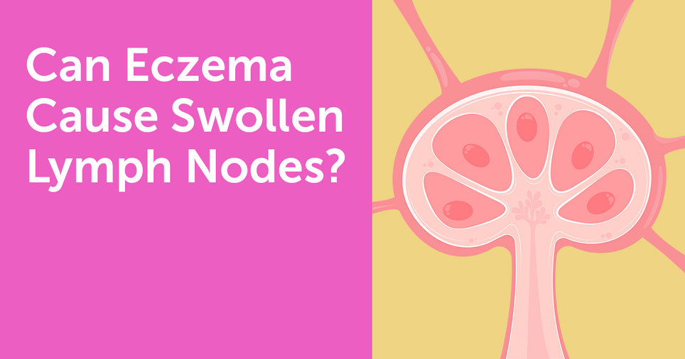 Eczema Symptoms MyEczemaTeam