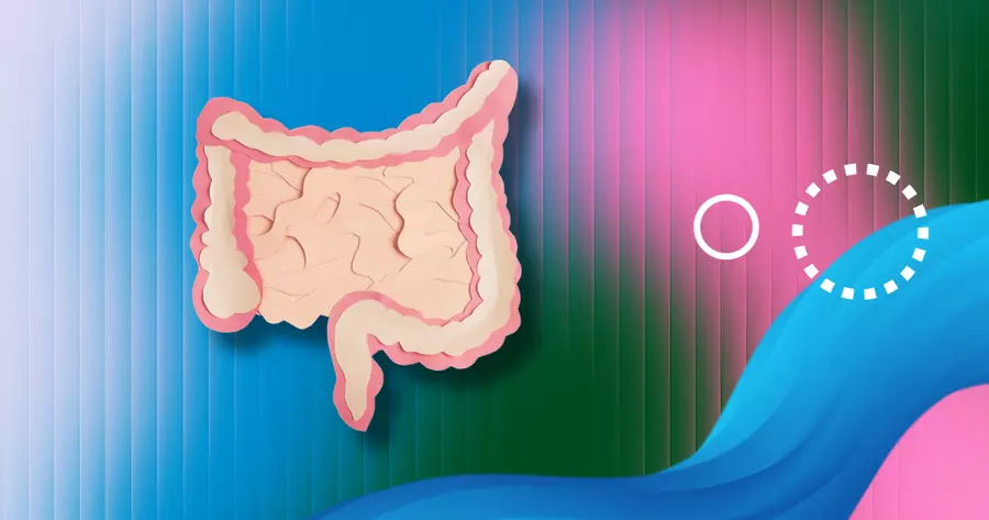 Abscesses With Crohn’s Disease: Symptoms, Treatment, and More (VIDEO ...