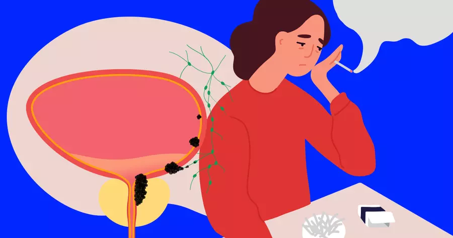 how do people use tobacco WHO report finds tobacco use is going down globally, but not as much as hoped : NPR how do people use tobacco WHO report finds tobacco use is going down globally, but not as much as hoped : NPR