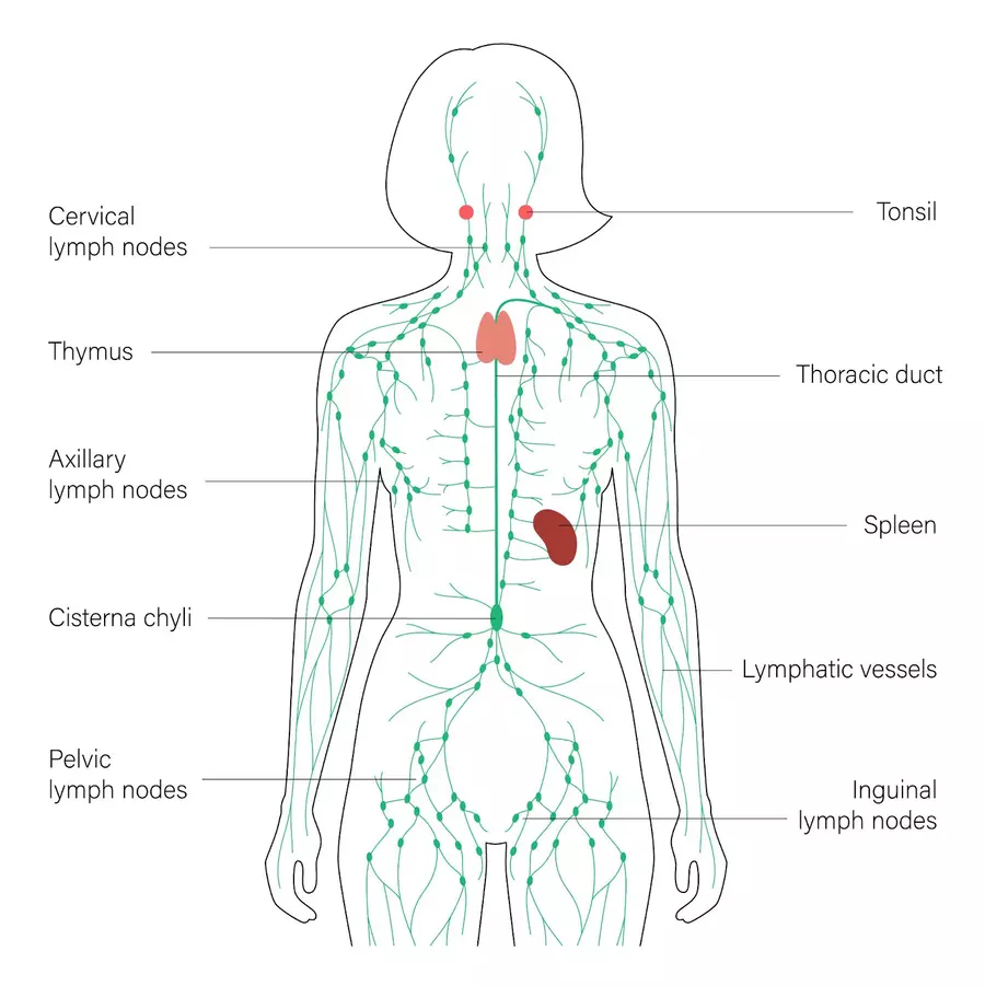 Alt text: Diagram of the lymphatic system showing lymph nodes, vessels, thymus, spleen, tonsils, cisterna chyli, and thoracic duct in a female body